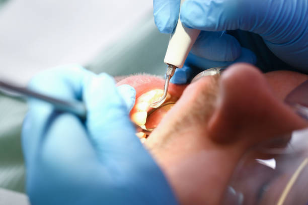 Best Emergency Gum Treatment in Bannockburn, IL
