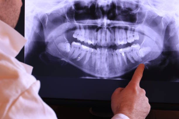 Best Emergency Treatment for Dental Infections or Abscesses in Bannockburn, IL